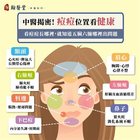 痘痘長的位置代表什麼|眉毛、人中長痘痘的原因？10個「青春痘位置」對應你。